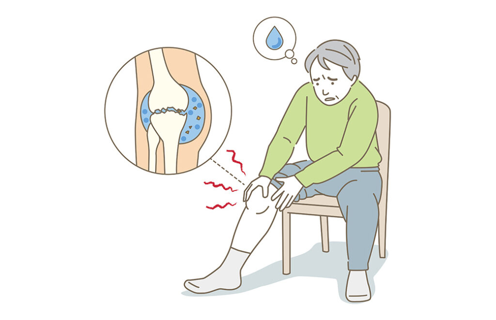 膝に水がたまった男性